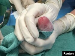 One of the giant panda cubs born on at the Smithsonian's National Zoo in Washington, DC is being examines by veterinarians in this image taken on August 22, 2015. A artificially inseminated giant panda took U.S. zoo officials by surprise on Saturday when