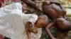 Deux enfants atteint du paludisme au centre de soins du village de Walikale au Congo le 19 septembre 2010.
