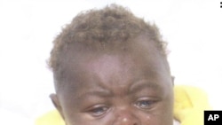 João, bebé de 4 meses, abandonado pela mãe e mais tarde recuperado