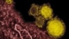 Arab Saudi: 3 Lagi Tewas Akibat Virus MERS