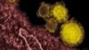 Virut gây chết người hoành hành ở Ả Rập Xê Út