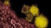 Second Case of MERS Identified in US