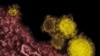 FILE - Rocky Mountain Laboratories shows novel coronavirus particles, also known as the MERS virus, colorized in yellow. 