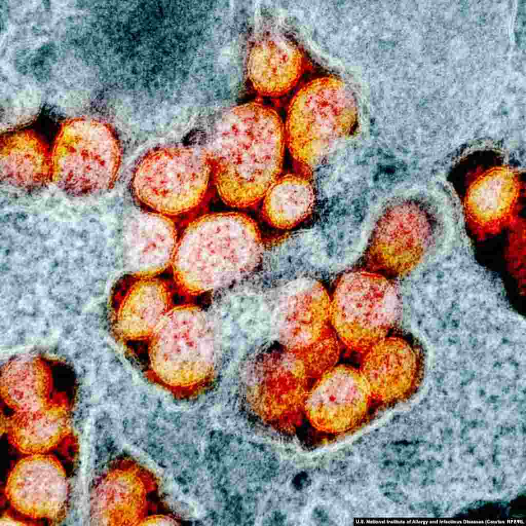 SARS-CoV-2 virusi mikroskop ostida. Bir virus zarrasi diametri 120 nanometrga tog&#39;ri keladi. Bu esa bir tola sochda eniga 750 ta virus zarrasi o&#39;rnashishi mumkin degani.&nbsp;