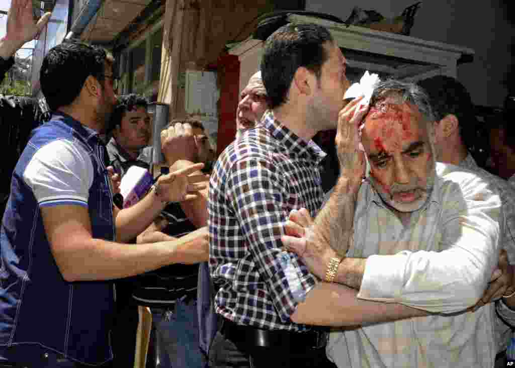 A Syrian man who was injured in a powerful explosion leaves a damaged building in the central district of Marjeh, in Damascus, Syria, April 30, 2013.