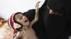 A woman holds her malnourished child at a feeding center at al-Sabyeen hospital in Yemen's capital, Sanaa, June 20, 2012.