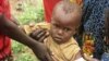 Child Malnutrition Spreading in Cameroon