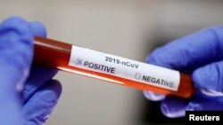 ARHIVA - Epruveta sa uzorkom krvi pozitivnim na koronavirus (Foto: Reuters/Dado Ruvić)