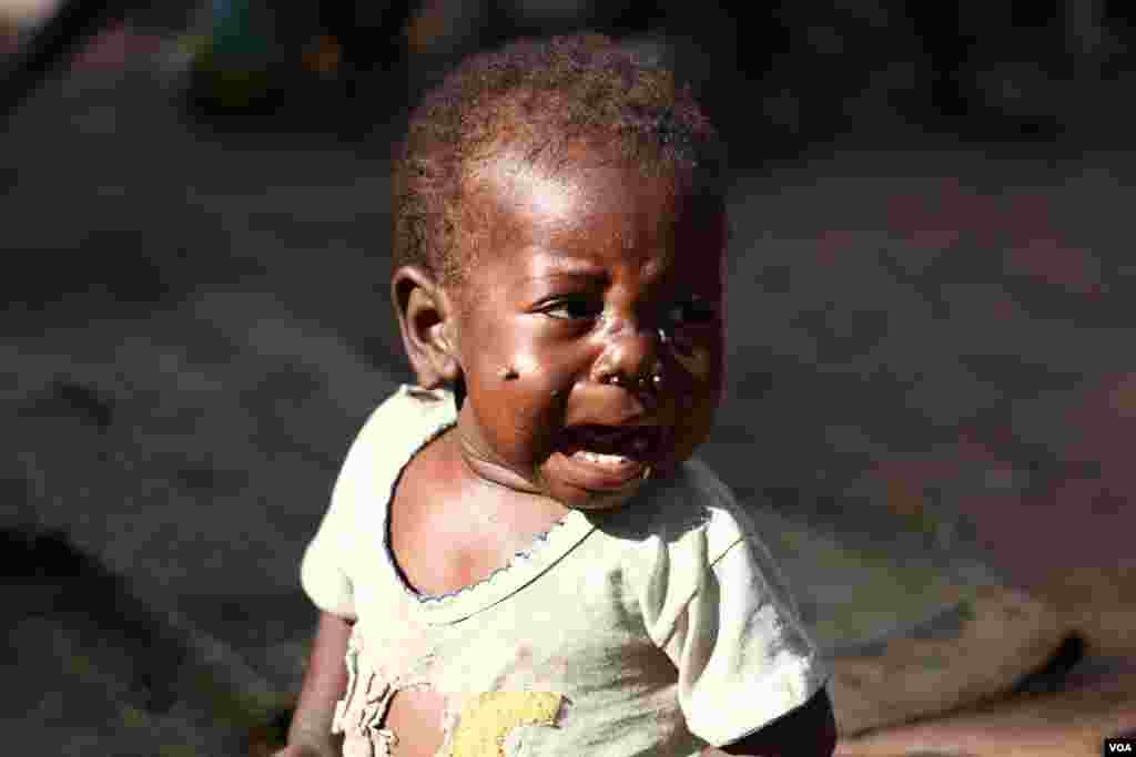 A ragged child cries out for food at Bossangoa&#39;s packed Catholic mission, where over 36,000 people have sought refuge from violence, Nov. 10, 2013. (Hanna McNeish for VOA)