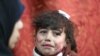 Hala, anak perempuan berusia 9 tahun yang mengalami luka-luka, menjalani perawatan di sebuah klinik darurat, setelah pasukan Suriah membombardir kota Saqba, Ghouta timur di luar ibu kota Damaskus.