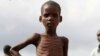 LHQ: Trẻ em chết tại trại tị nạn ở Ethiopia với tỉ lệ báo động
