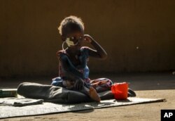 FILE - Two-year-old Akon Morro, who is anemic and suffers from edema due to malnutrition, sits on the floor of a feeding center in Al Sabah Children's Hospital in the capital Juba, South Sudan, Dec. 3, 2020.
