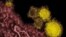 Mountain Laboratories shows novel coronavirus particles, also known as the MERS virus, colorized in yellow. 