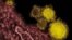 Mountain Laboratories shows novel coronavirus particles, also known as the MERS virus, colorized in yellow. 
