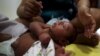 Scientists Inching Closer to Establishing Zika-Microcephaly Link