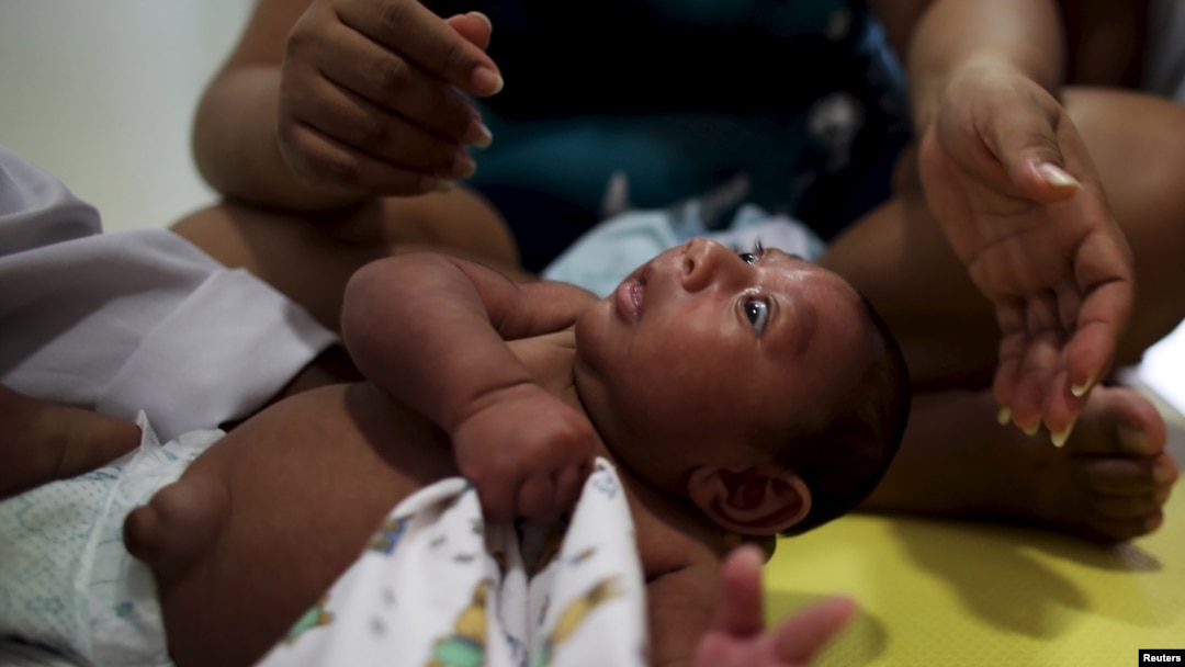 Gustavo Henrique who is 2-months old and born with microcephaly, reacts to stimulus during an evaluation session with a physiotherapist at the Altino Ventura rehabilitation center in Recife, Brazil, Feb. 11, 2016. 