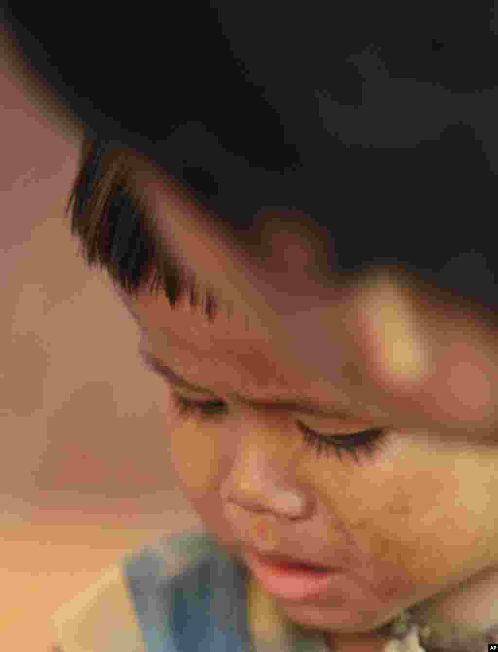 柬埔寨的一位年仅3岁的爱滋病患者。(Reuters)