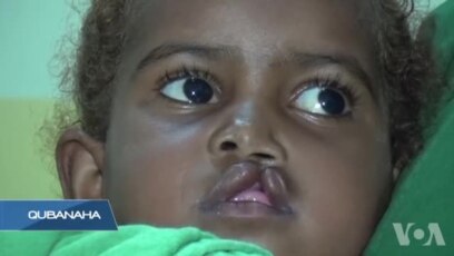 Muqdisho: Caruur Faruuran oo Qaliin Lagu Sameeyay