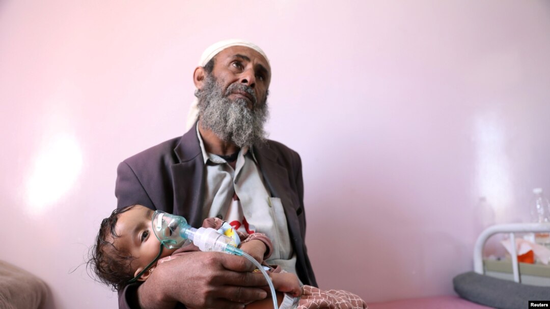 A man holds his malnourished daughter at a malnutrition treatment ward of al-Sabeen hospital in Sanaa, Yemen, Oct. 27, 2020. 