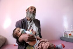 FILE - A man holds his malnourished daughter at a malnutrition treatment ward of al-Sabeen hospital in Sanaa, Yemen, Oct. 27, 2020.