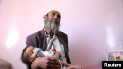 A man holds his malnourished daughter at a malnutrition treatment ward of al-Sabeen hospital in Sanaa, Yemen, Oct. 27, 2020. 