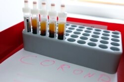 Blood samples are prepared for testing for the corona virus at a laboratory in Berlin, Germany, March 26, 2020, as the spread of the coronavirus disease (COVID-19) continues.