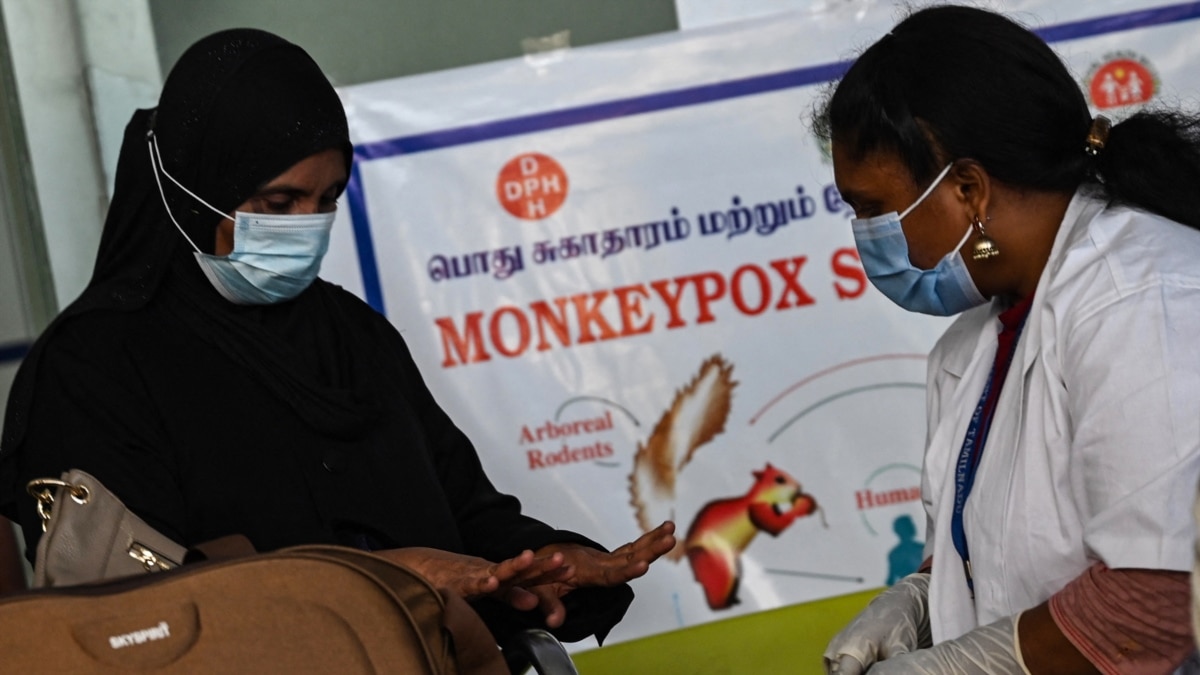 More Than 700 Monkeypox Cases Globally, 21 in US, CDC Says - Vimarsana News
