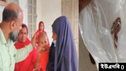 শিশুর কামড়ে বাচ্চা সাপের মৃত্যু