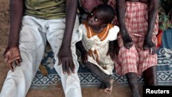 FILE - A girl sits between her leprosy-afflicted parents. A leprosy isolation camp in Bor County’s Malek village, located in South Sudan's Jonglei state, has just received aid supplies for the first time in two years.