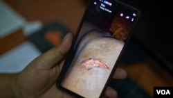 Ethiopian community activists show pictures of injuries sustained by refugees on July 27, 2020 in Cairo. (VOA/Hamada Elrasam) 