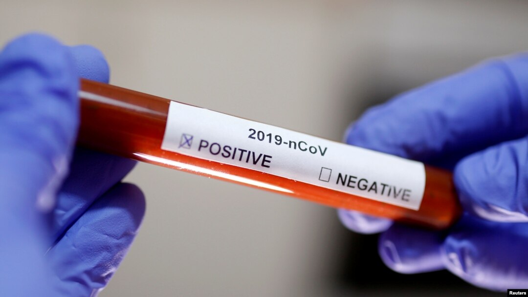ILUSTRACIJA - Epruveta sa testom na koronavirus (Foto: Reuters/Dado Ruvić)