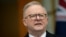 FILE - Australia's Prime Minister Anthony Albanese in Canberra, Australia, Aug. 16, 2024. Albanese said he wants to get children off social media "to have real experiences with real people because we know that social media is causing social harm." 