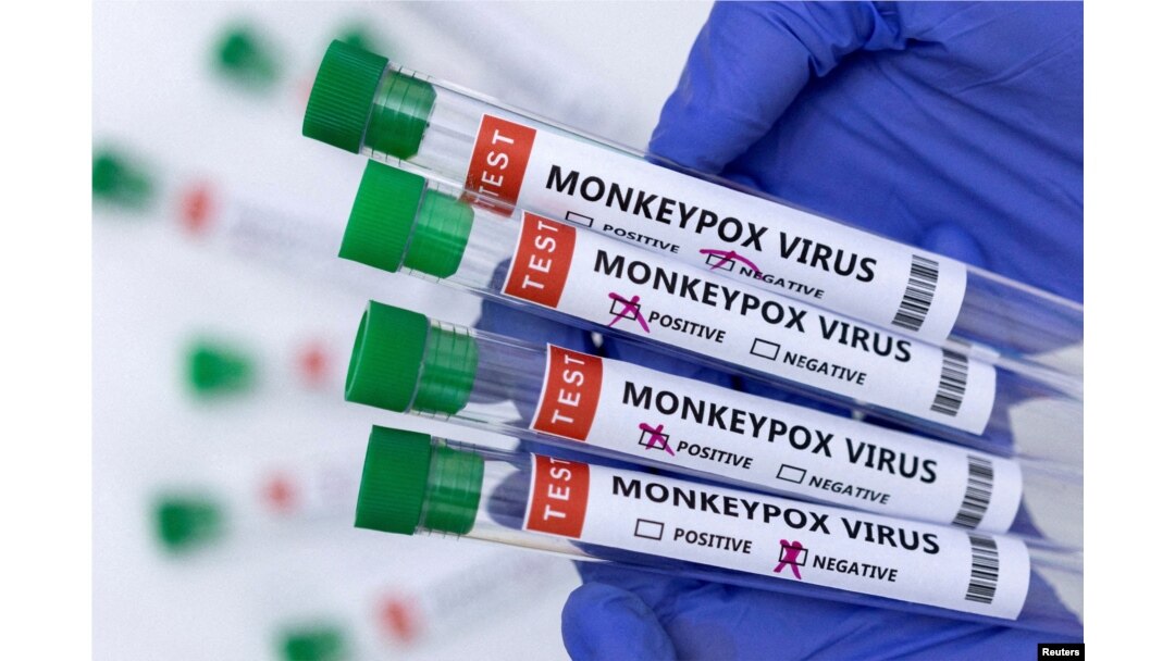 Ilustrasi tabung reaksi berlabel "Virus cacar monyet positif dan negatif", 23 Mei 2022. (Foto: REUTERS/Dado Ruvic)