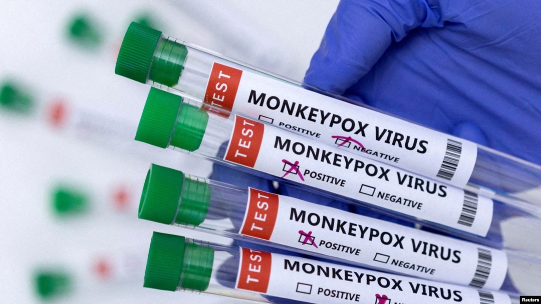 Ilustrasi - Tabung reaksi berlabel "Virus Monkeypox positif dan negatif", 23 Mei 2022. (REUTERS/Dado Ruvic)