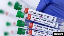 FILE: Test tubes labelled "Monkeypox virus positive and negative" are seen in this illustration taken 5.23.2022