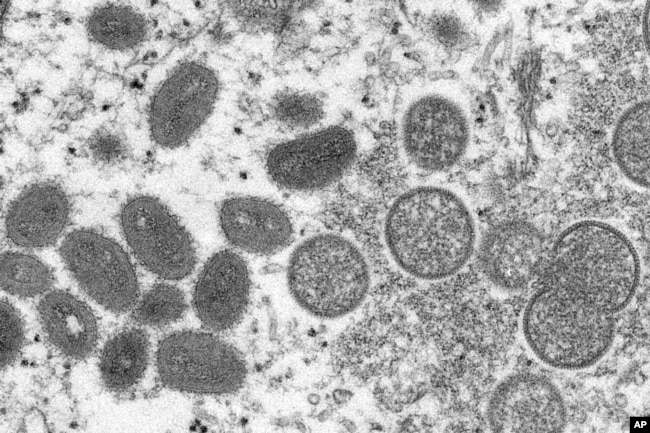 his 2003 electron microscope image made available by the Centers for Disease Control and Prevention shows mature, oval-shaped monkeypox virions.