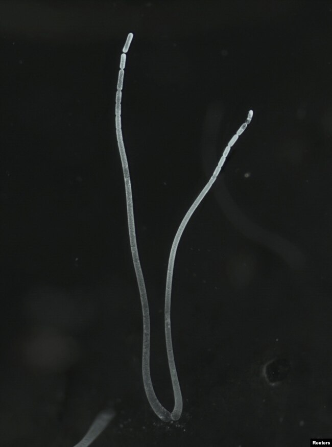 Filaments of the bacterium Thiomargarita magnifica from Guadeloupe, a French archipelago in the Caribbean, are seen in this undated handout image. (Jean-Marie Volland/U.S. Department of Energy's Lawrence Berkeley National Laboratory/Handout via REUTERS)