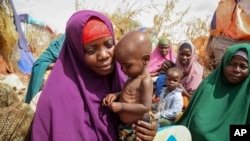 Nunay Mohamed, 25, who fled the drought-stricken Lower Shabelle area, holds her one-year old malnourished child at a makeshift camp for the displaced on the outskirts of Mogadishu, Somalia, on June 30, 2022. Somalia is perhaps the most vulnerable as thousands die of hunger amid the driest drought in decades.