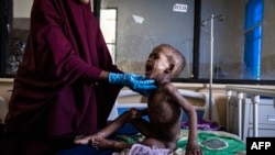 FILE - Ali Abdullahi Mohamed, a severely malnourished 27-month-old boy, is examined by a nurse for treatment in Banadir Maternity and Children Hospital in Mogadishu, Somalia, June 1, 2022. 
