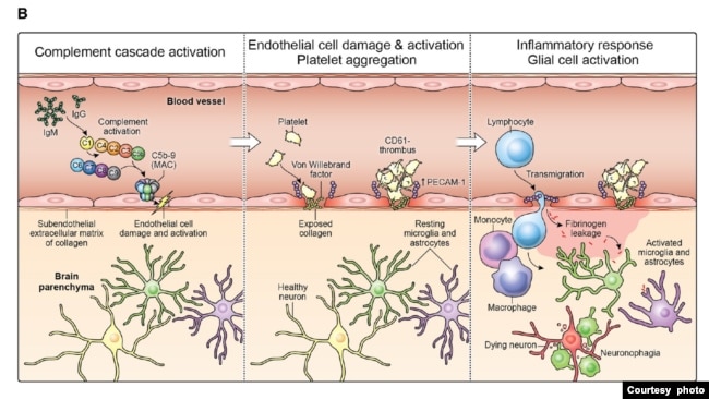 The proposed cascade of events to explain the neuropathological findings in the study. (Courtesy of NIH)