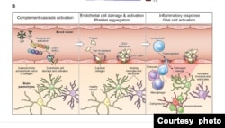 The proposed cascade of events to explain the neuropathological findings in the study. (Courtesy of NIH)