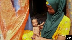 Amina Shuto, 21, holds her two-month old malnourished child at a makeshift camp for the displaced on the outskirts of Mogadishu, Somalia, on June 30, 2022. Since January, at least 200,000 children have died due to malnutrition in Somalia.