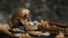 FILE - Parts of one of 25 skeletons found during construction work in central London are pictured, March 26, 2014. Archaeologists suspected the bones came from a cemetery for Black Death victims in the 14th century.