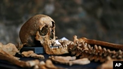 资料照片：在伦敦中部发现的人体遗骨，考古学者认为，这些遗骨可能来自一处埋葬黑死病死难者的墓地。(2014年3月26日) 