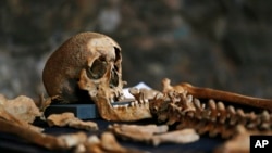 FILE - Parts of one of 25 skeletons found during construction work in central London are pictured, March 26, 2014. Archaeologists suspected the bones came from a cemetery for Black Death victims in the 14th century.