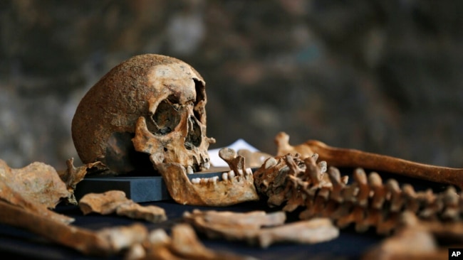 FILE - Parts of one of 25 skeletons found during construction work in central London are pictured, March 26, 2014. Archaeologists suspected the bones came from a cemetery for Black Death victims in the 14th century.