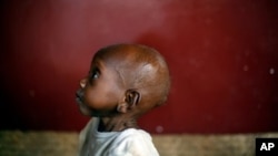 Waka, aged 2, a severely malnourished child sits on the floor at Bangui's pediatric center in Bangui, Central African Republic, Tuesday, Dec. 17, 2013. According to UNICEF's doctor Celestin Traore, even though malnutrition is high in the country, the prob