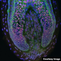 For the first time, researchers have been able to take human dermal papilla cells (those inside the base of human hair follicles) and use them to create new hairs. (Claire Higgins/Christiano Lab at Columbia University Medical Center)