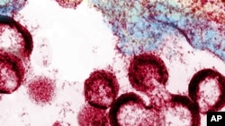 HIV virions budding and releasing from an infected cell