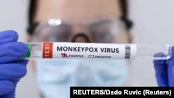 Tubo de una prueba positiva de viruela del mono tomada el 23 de mayo de 2022. Foto Reuters.